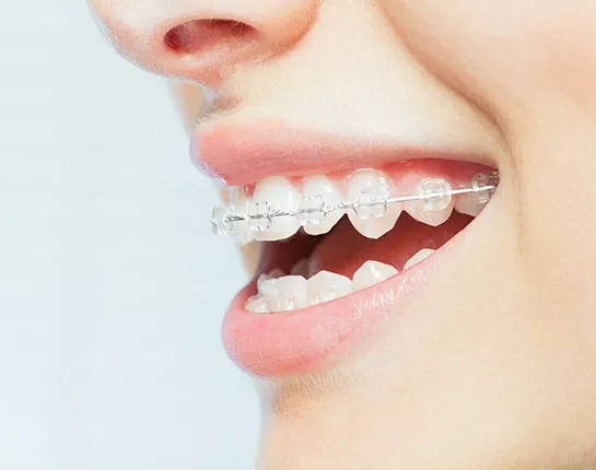 矯正専門医による矯正治療を実施